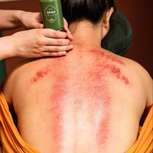 Giảm Đau Nhức Tại Nhà Chỉ Với Kem Massage Gừng Cô Ba?