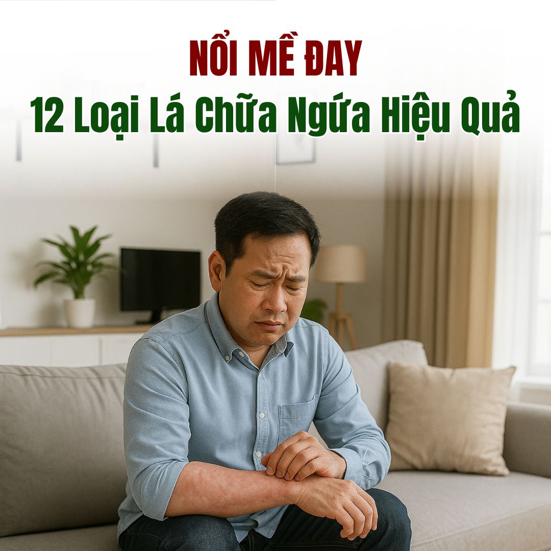 Nổi Mề Đay Tắm Lá Gì? 12 Loại Lá Chữa Ngứa Hiệu Quả Từ Xưa Đến Nay