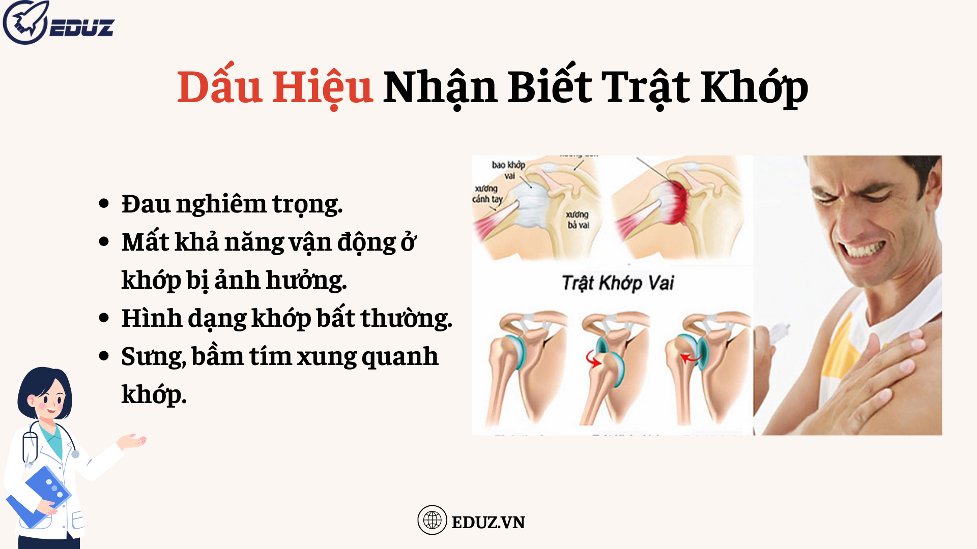 2. Dấu Hiệu Nhận Biết Trật Khớp