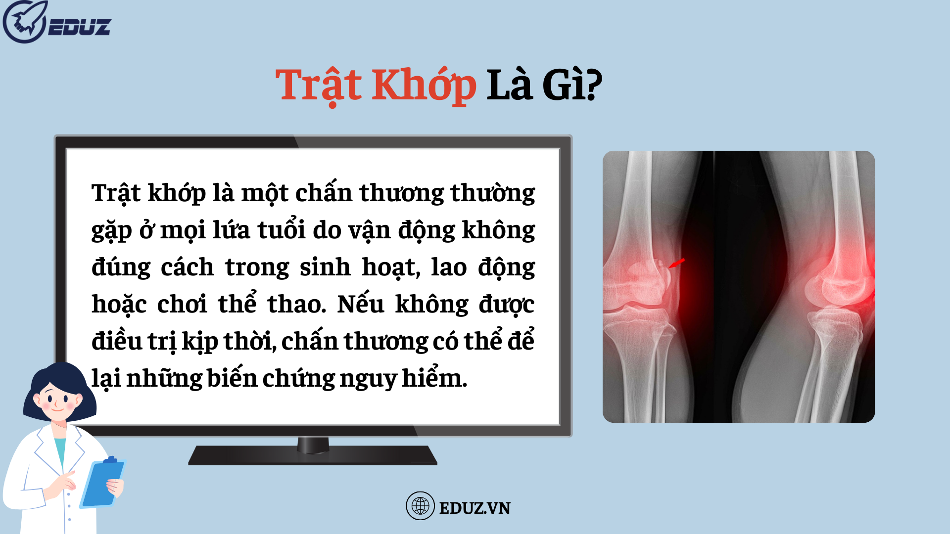 1. Trật Khớp Là Gì?