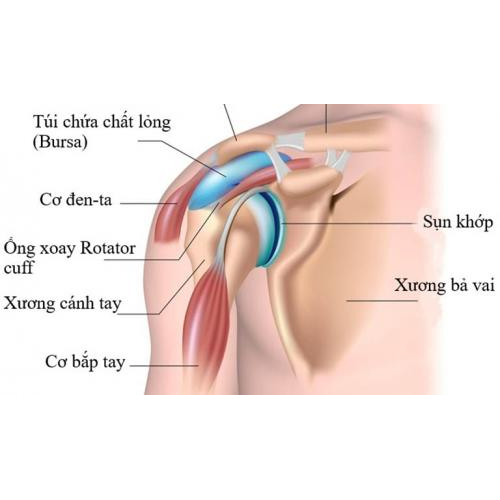 Bỏ túi ngay 6 nguyên nhân gây ĐAU BẢ VAI LAN XUỐNG CÁNH TAY - Cẩn thận kẻo muộn!